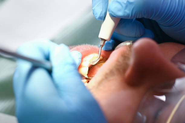 Best Emergency Dental Care for Sports Injuries in The Plains, OH