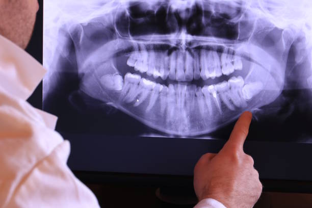 Best Knocked-Out Tooth (Avulsed Tooth) Treatment in The Plains, OH