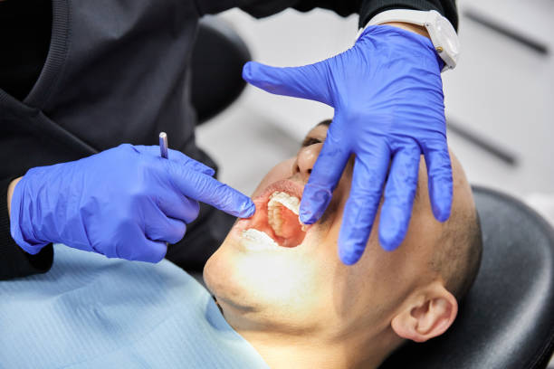 Best Broken or Chipped Tooth Repair in The Plains, OH